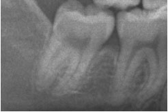 %e5%9f%8b%e4%bc%8f7%e7%95%aa%e5%9f%8b%e4%bc%8fup%e3%80%80right